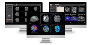 Unlocking Potential: How Advanced Image Processing Scanners Revolutionize Precision and Creativity in Digital Imaging